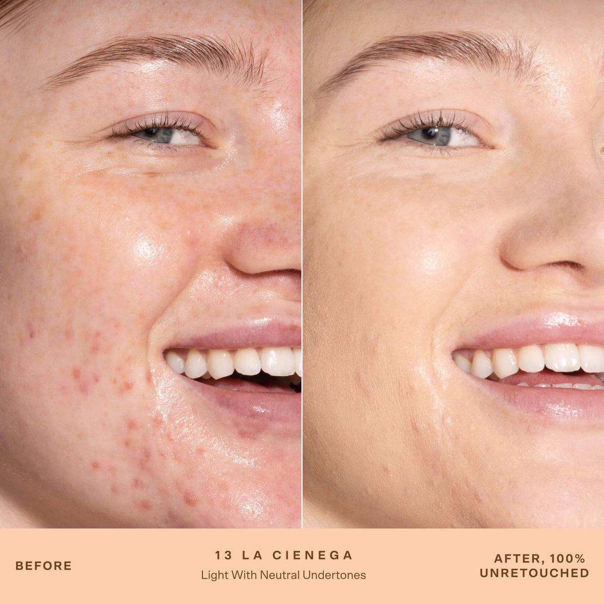 SunnyDays™ Tinted SPF 30 A7