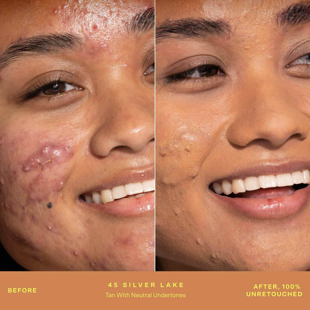 SunnyDays™ Tinted SPF 30 A7