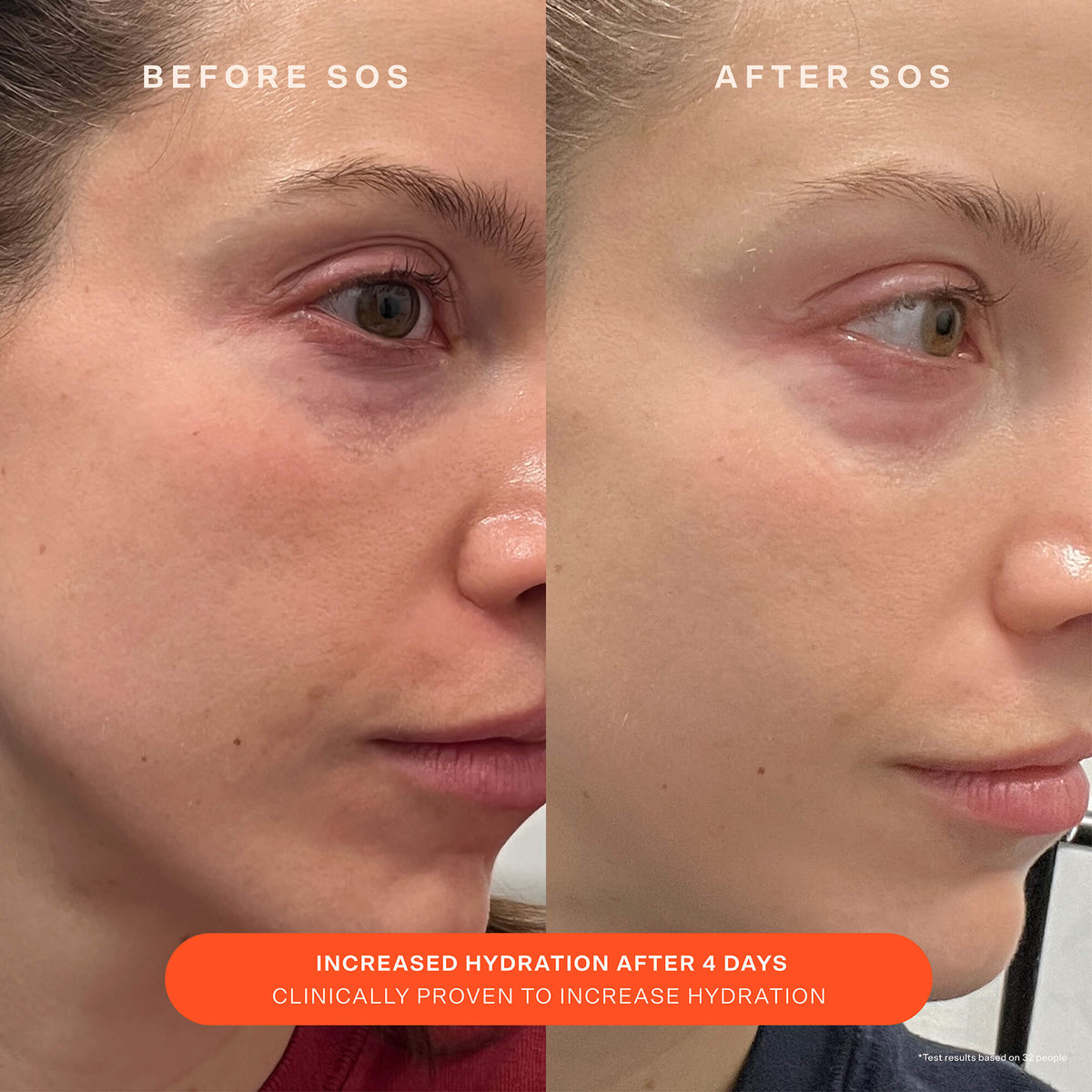 SOS Recovery Cream Z1