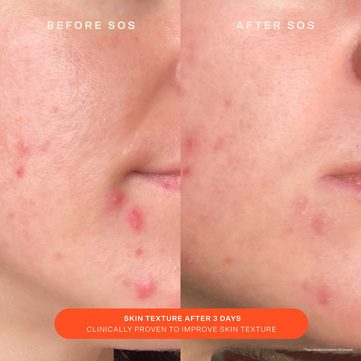 SOS Recovery Cream Z1