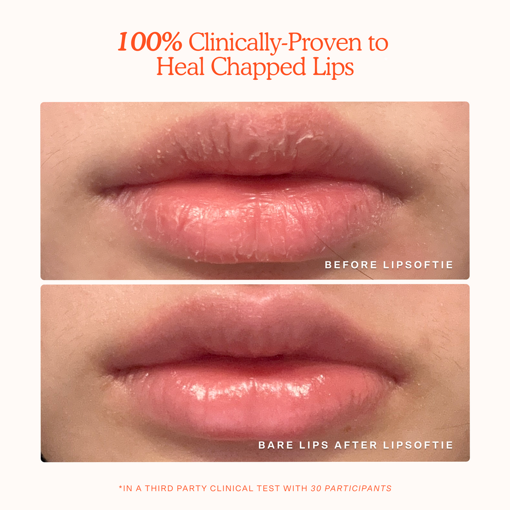LipSoftie® Lip Treatment L0