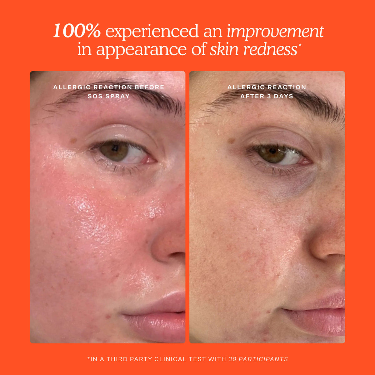 SOS 3-Step Skincare Set I2