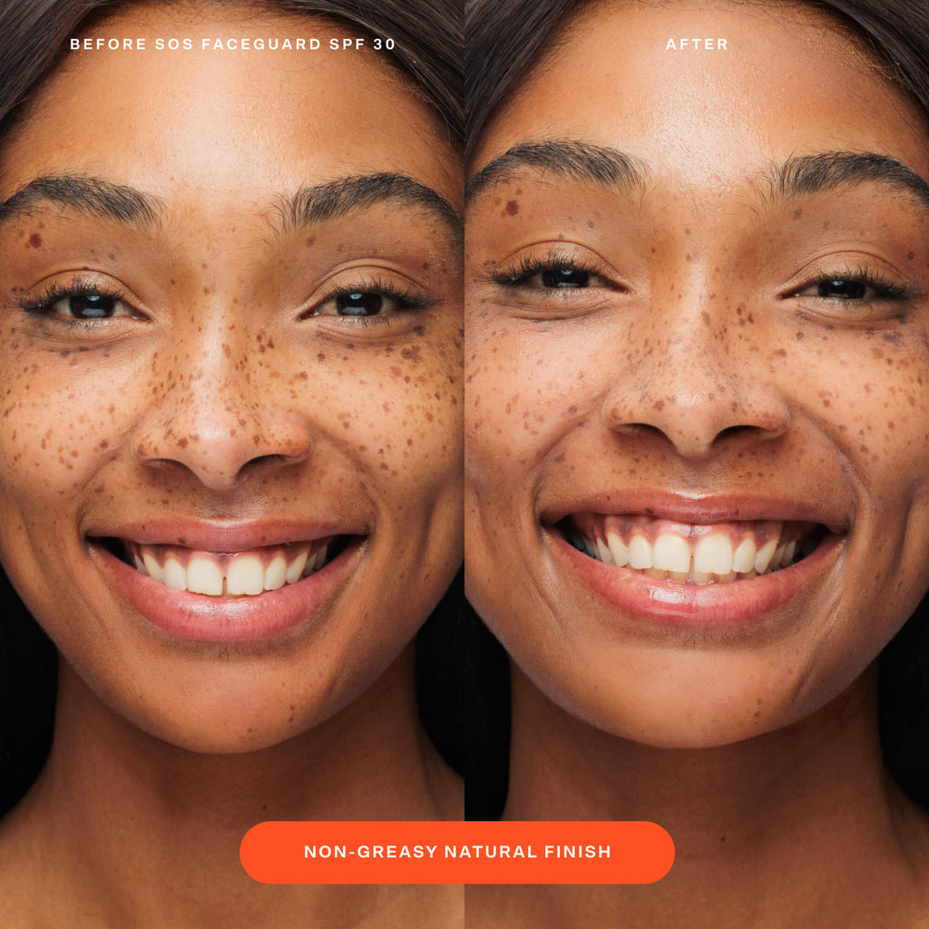 SOS FaceGuard™ SPF 30 Sunscreen PA+++ A2
