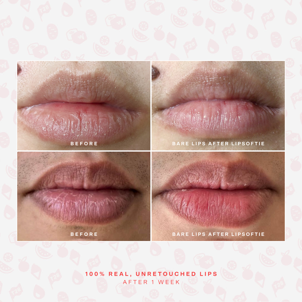 LipSoftie® Lip Treatment Set F4