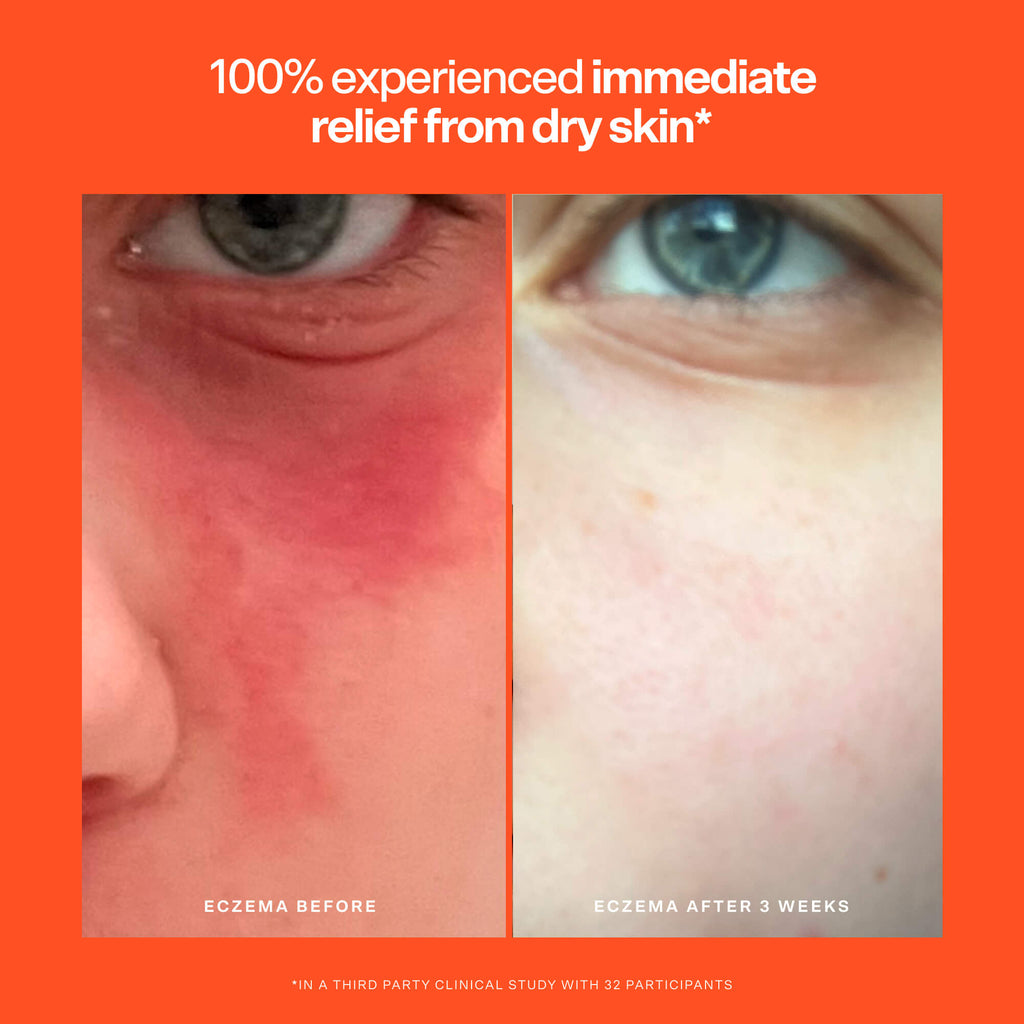 SOS Rescue Serum L2