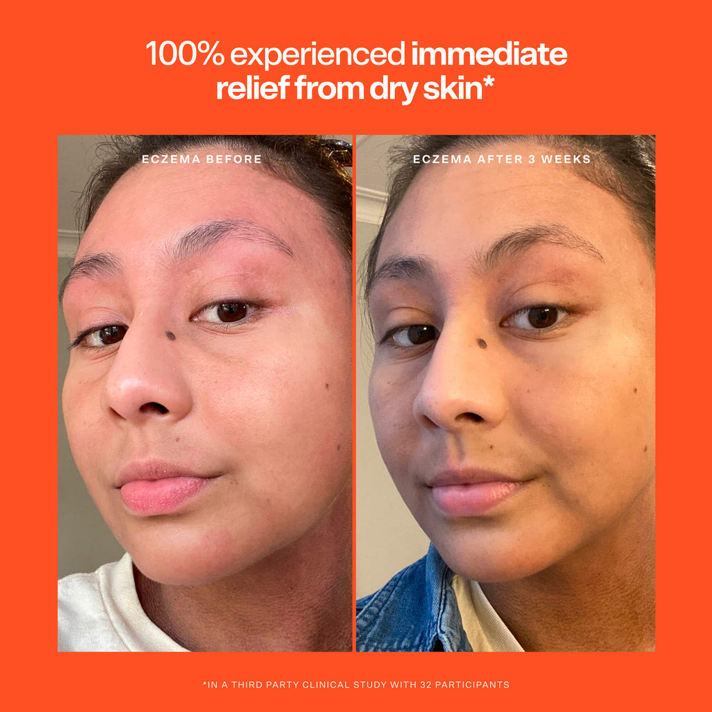 SOS Rescue Serum L2