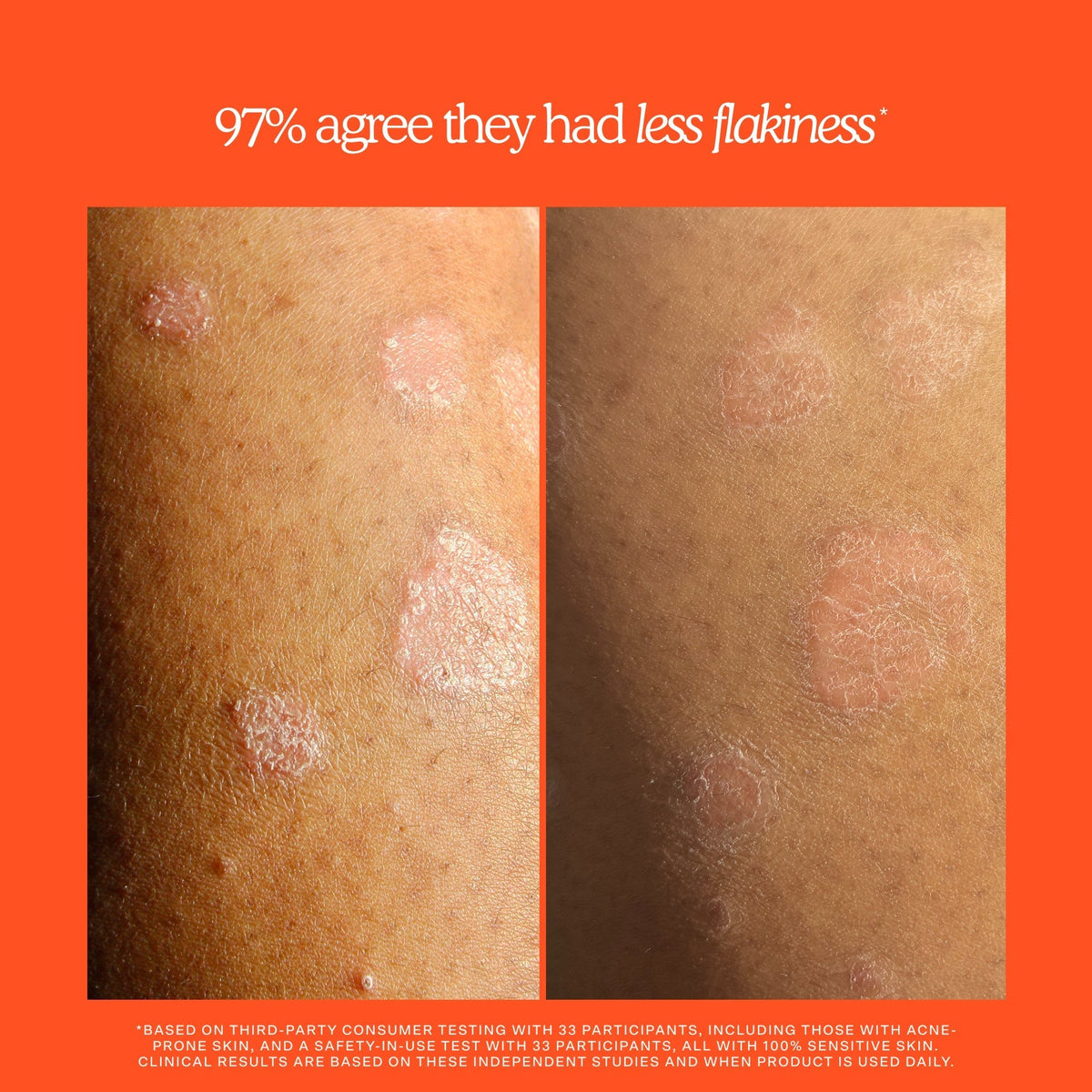 SOS Rescue + Relief Body Wash Treatment B5