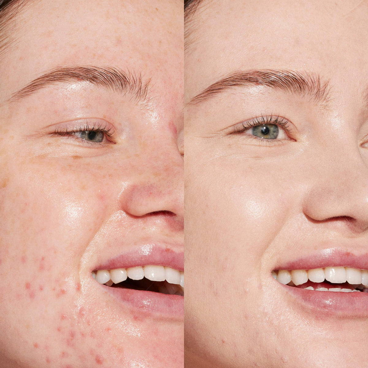 Swipe Serum Concealer® V7